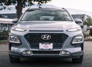 2019 Hyundai Kona 2.0L Preferred S625471A